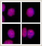 PRMT2 Antibody in Immunocytochemistry (ICC/IF)