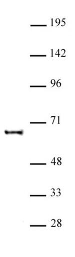 KAT5 Antibody in Western Blot (WB)