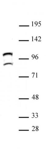STAT6 Antibody in Western Blot (WB)