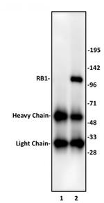 RB1 Antibody in Immunoprecipitation (IP)