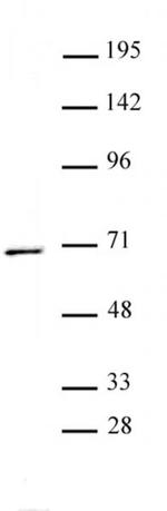PPM1D Antibody in Western Blot (WB)