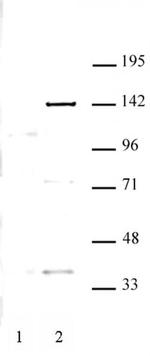 KDM4C Antibody in Western Blot (WB)