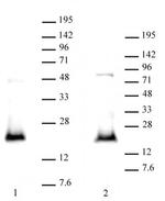 CDKN2A p14ARF Antibody in Western Blot (WB)