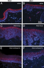 Occludin Antibody in Immunohistochemistry (Paraffin) (IHC (P))