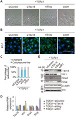 ZO-1 Antibody in Immunocytochemistry (ICC/IF)