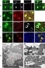 ZO-1 Antibody in Immunocytochemistry (ICC/IF)