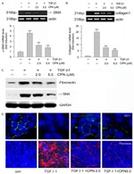 ZO-1 Antibody in Immunocytochemistry (ICC/IF)