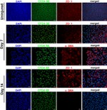 ZO-1 Antibody in Immunohistochemistry, Immunocytochemistry (IHC, ICC/IF)