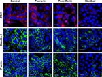 ZO-1 Antibody in Immunocytochemistry (ICC/IF)