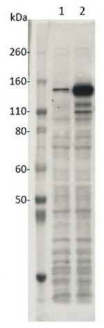 SaCas9 Antibody in Western Blot (WB)