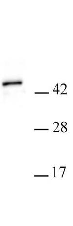 PHF6 Antibody in Western Blot (WB)