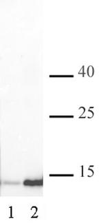 Histone H3K4ac Antibody in Western Blot (WB)