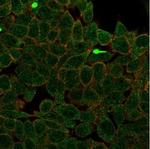 ZNF704/Zinc finger protein 704 Antibody in Immunocytochemistry (ICC/IF)