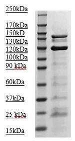 Phospho-JAK2 (Tyr1007, Tyr1008) Antibody in Western Blot (WB)
