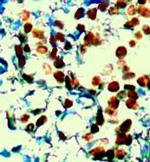 Phospho-ER (Ser305) Antibody in Immunohistochemistry (Paraffin) (IHC (P))