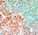 MEK5 (MAPKK5) Antibody in Immunohistochemistry (Paraffin) (IHC (P))