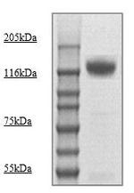 Phospho-Neuropilin-1 (Thr916) Antibody in Western Blot (WB)