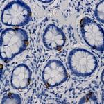 Neuropilin-1 Antibody in Immunohistochemistry (Paraffin) (IHC (P))