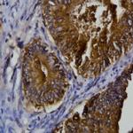 PLAC1 Antibody in Immunohistochemistry (Paraffin) (IHC (P))