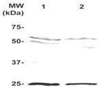 PLAC1 Antibody in Western Blot (WB)