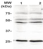 Phospho-PLAC1 (Tyr147) Antibody in Western Blot (WB)