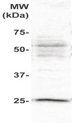 PLAC1 Antibody in Western Blot (WB)