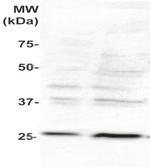 Phospho-PLAC1 (Ser156) Antibody in Western Blot (WB)