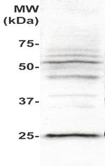 PLAC1 Antibody in Western Blot (WB)
