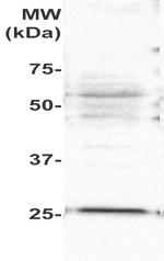 PLAC1 Antibody in Western Blot (WB)