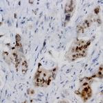 VIR Antibody in Immunohistochemistry (Paraffin) (IHC (P))