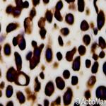 p15INK4b Antibody in Immunocytochemistry (ICC/IF)