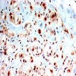 PAX8 Antibody in Immunohistochemistry (Paraffin) (IHC (P))