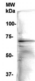 NFkBp65 Antibody in Western Blot (WB)