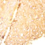 Tau Antibody in Immunohistochemistry (Paraffin) (IHC (P))