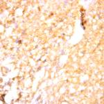 Phospho-Tau (Ser384) Antibody in Immunohistochemistry (Paraffin) (IHC (P))