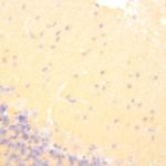 Tau Antibody in Immunohistochemistry (Paraffin) (IHC (P))