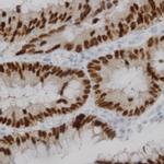 Phospho-c-Fos (Thr232) Antibody in Immunohistochemistry (Paraffin) (IHC (P))