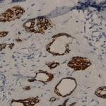 Phospho-RalA (Ser196) Antibody in Immunohistochemistry (Paraffin) (IHC (P))