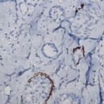 RalA Antibody in Immunohistochemistry (Paraffin) (IHC (P))