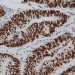 Phospho-IKK-a (Ser176, Ser180) Antibody in Immunohistochemistry (Paraffin) (IHC (P))