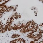 Phospho-IKK-b (Tyr199) Antibody in Immunohistochemistry (Paraffin) (IHC (P))
