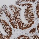 IKK-b Antibody in Immunohistochemistry (Paraffin) (IHC (P))