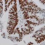 IKK-a Antibody in Immunohistochemistry (Paraffin) (IHC (P))
