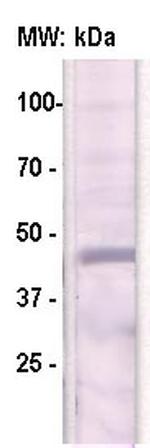 HPV (Human Papillomavirus), E7 protein Antibody in Western Blot (WB)