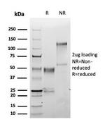 S100A1 (Melanoma Marker) Recombinant Rabbit Monoclonal Antibody (S100A1/6374R)