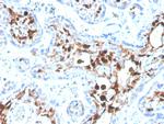 S100A4/Metastasin/Calvasculin (Marker of Tumor Metastasis) Antibody in Immunohistochemistry (Paraffin) (IHC (P))