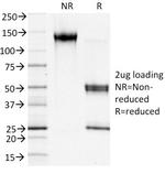 S100A4/Metastasin/Calvasculin (Marker of Tumor Metastasis) Antibody in SDS-PAGE (SDS-PAGE)