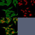 S100A4/Metastasin/Calvasculin Antibody in Immunocytochemistry (ICC/IF)