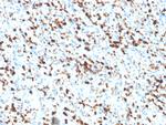 S100A4/Metastasin/Calvasculin (Marker of Tumor Metastasis) Antibody in Immunohistochemistry (Paraffin) (IHC (P))