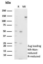 S100A4/Metastasin/Calvasculin (Marker of Tumor Metastasis) Antibody in SDS-PAGE (SDS-PAGE)